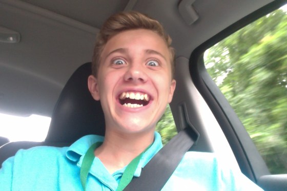 Before pic...scary teeth